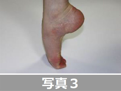 足指体操 足指体操